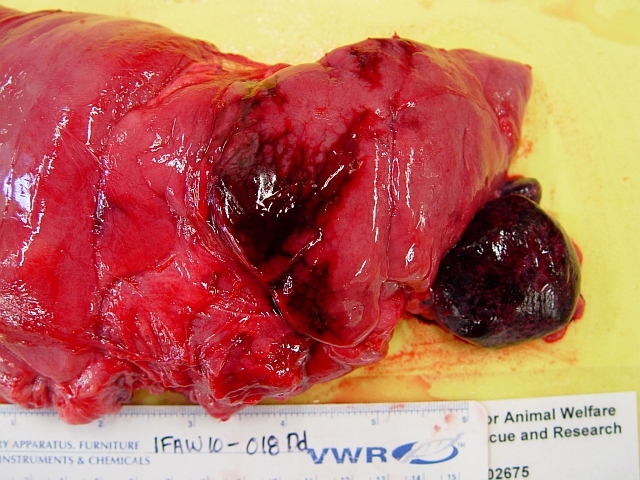 Hemorrhagic Pancreas and Spleen